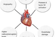 Is Cbd a Vasodilator or Vasoconstrictor