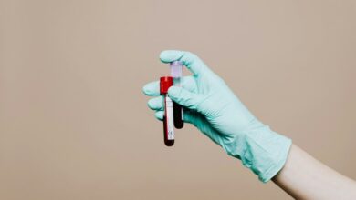 cbd detection in blood