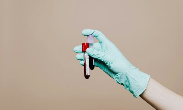 cbd detection in blood